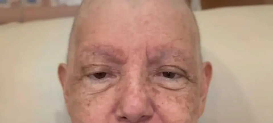 Roseana Sarney adia quimioterapia após ser internada com pneumonia - Imagem do artigo original